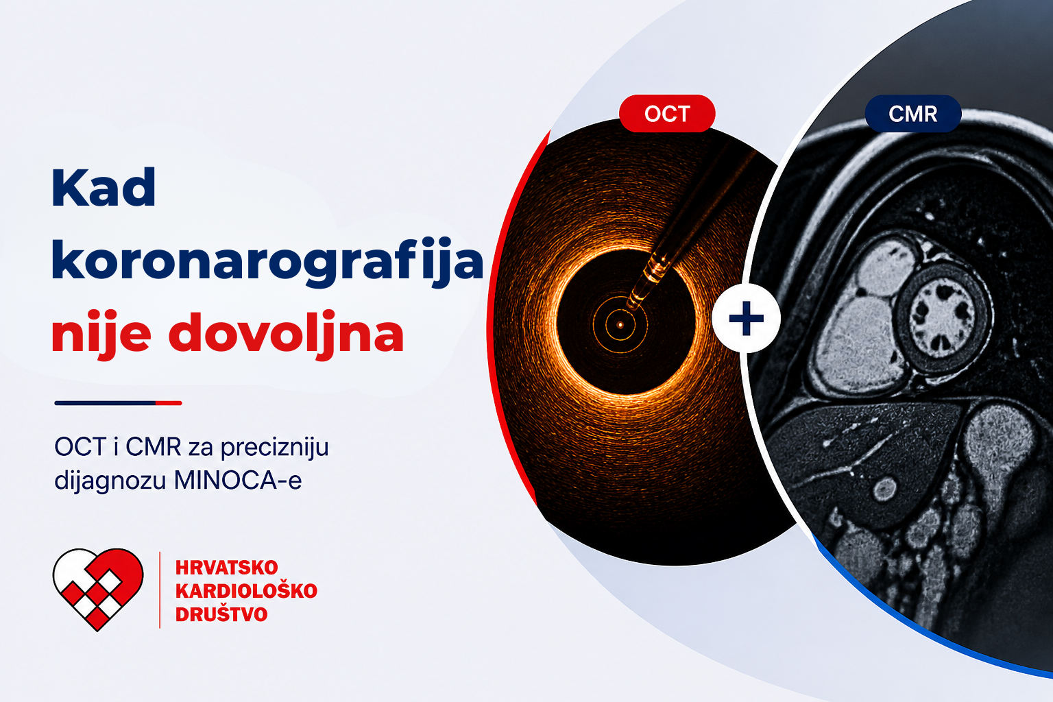 Multimodalno oslikavanje u otkrivanju uzroka MINOCA-e