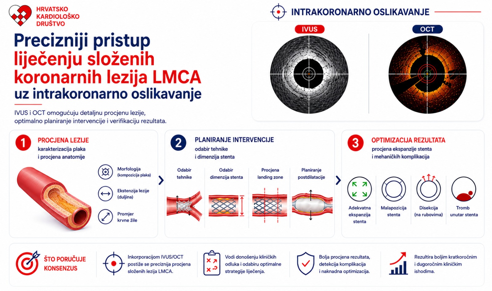 Intrakoronarno oslikavanje u PCI zahvatima na lijevom glavnom koronarnom deblu