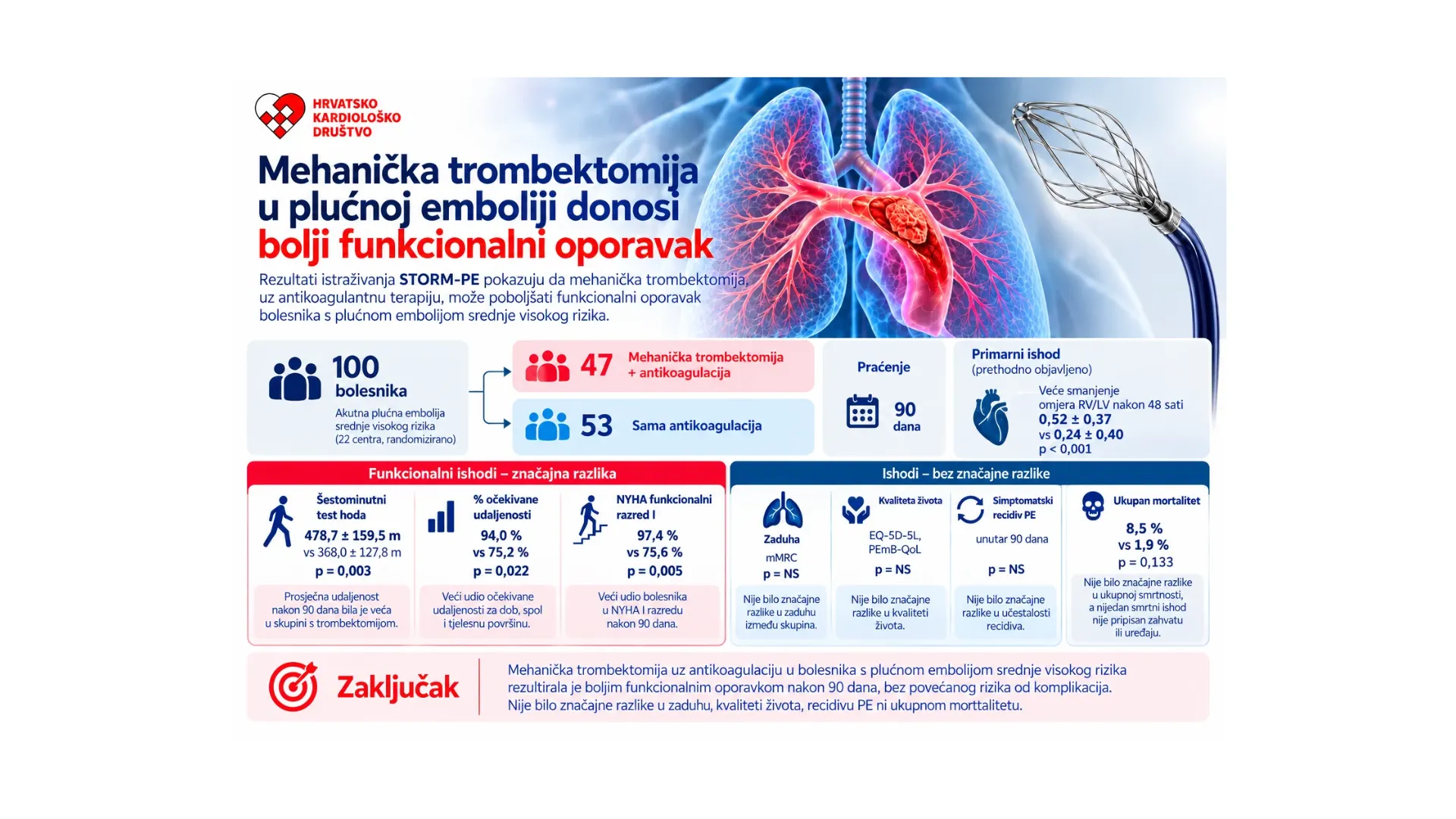 Mehanička trombektomija kod plućne embolije srednje visokog rizika: jesmo li bliže promjeni kliničke prakse?